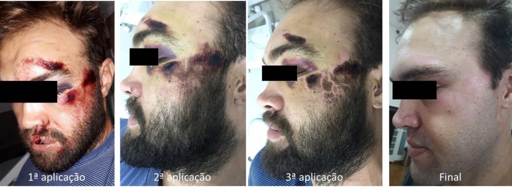 sergio 1