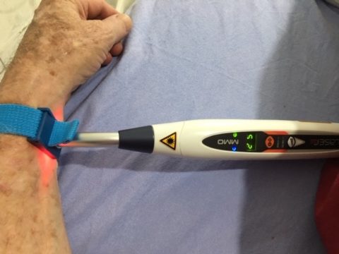 Ilib Modificado Fotobiomodulação Sistêmica Vascular – A Terapia “ILIB” - MMOptics