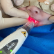 Laser Duo Pediatria